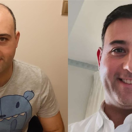 Prima e dopo